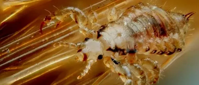 Does Dawn Dish Soap Kill Lice? The Surprising Answer!
