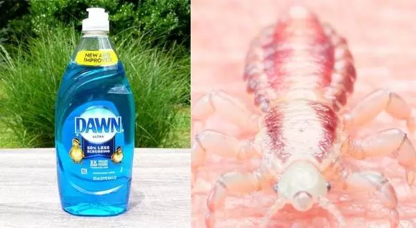 How to use dawn dish soap to kill lice?